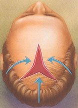 hair_replacement-6